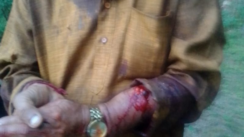 दुगड्डा में 70 वर्षीय वृद्ध पर गुलदार ने किया हमला,,,।